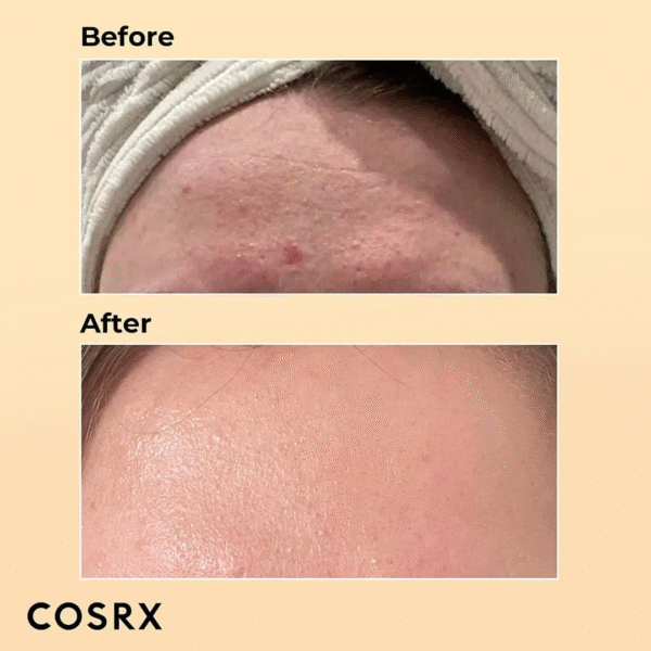 COSRX Advanced Snail 96 Mucin  Power Essence 100ml/3.38Floz - Image 11