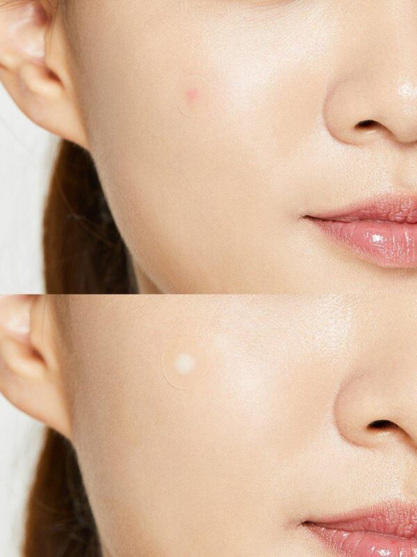 [COSRX] Acne Pimple Master 24 patches - Image 5